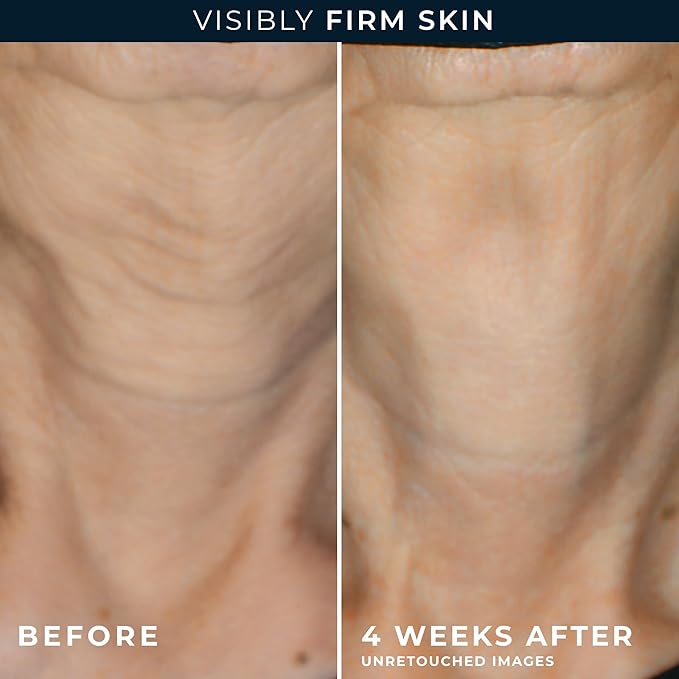 RoC Crepe Repair Anti Aging Daily Face Moisturizer & Neck Firming Cream (1.7 oz) + RoC Retinol Wrinkle Smoothing Capsules (7 CT), Skin Care Routine for Women and Men