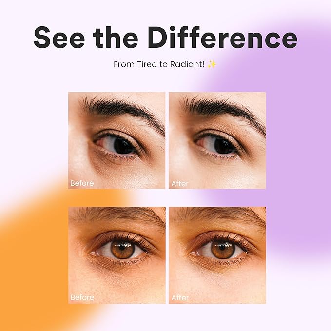 BLAQ Snow Circles Premium Under Eye Hydrating Patches for Dry Skin, Dark Circles and Puffiness. Snow Mushroom, Green Tea, Marine Algae, Vegan and Cruelty-Free, 30-Pack