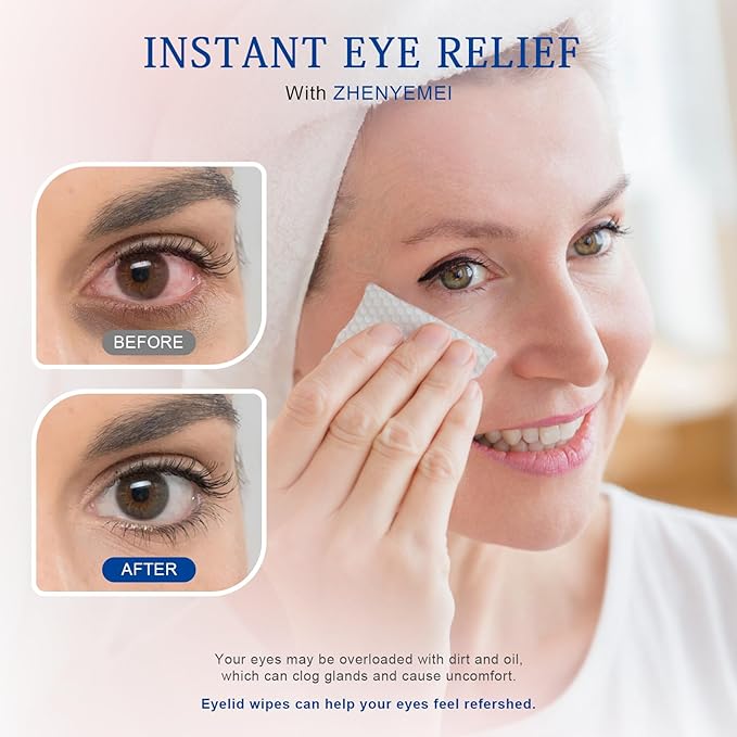 30PCS Tea Tree Oil Eyelid Cleansing Wipes,For Dry Eyes Daily Eye Care&Makeup Remover with Physiological Saline Removing Oil and Debris from Eyelids, Rinse Free Individually Wrapped Travel Eye Wipes 