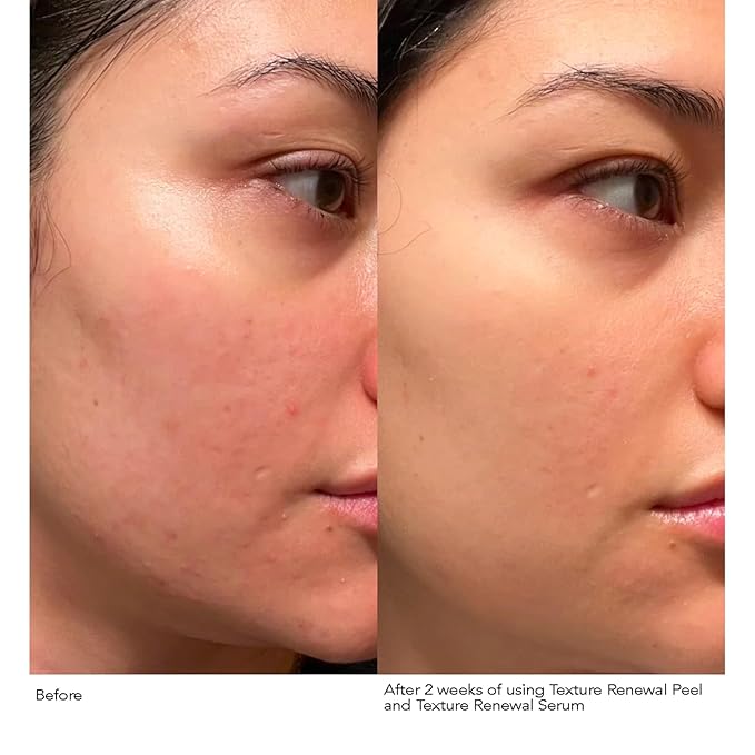 Dr. Dennis Gross Advanced Retinol + Ferulic Serum – Anti-Aging Formula to Smooth Texture, Boost Radiance, and Minimize Fine Lines & Wrinkles, 1 oz