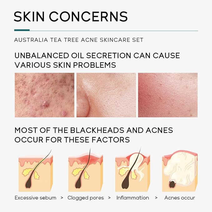 Skin Care Set,Acne Treatment for Face Skin Care Sets & Kits,Tea Tree Essential Oil Facial Skincare Gift Set with Cleanser,Toner,Serum,Gel, Acne Treatment Kit Cream Skin Care for Teens 10-12 Girls Boys