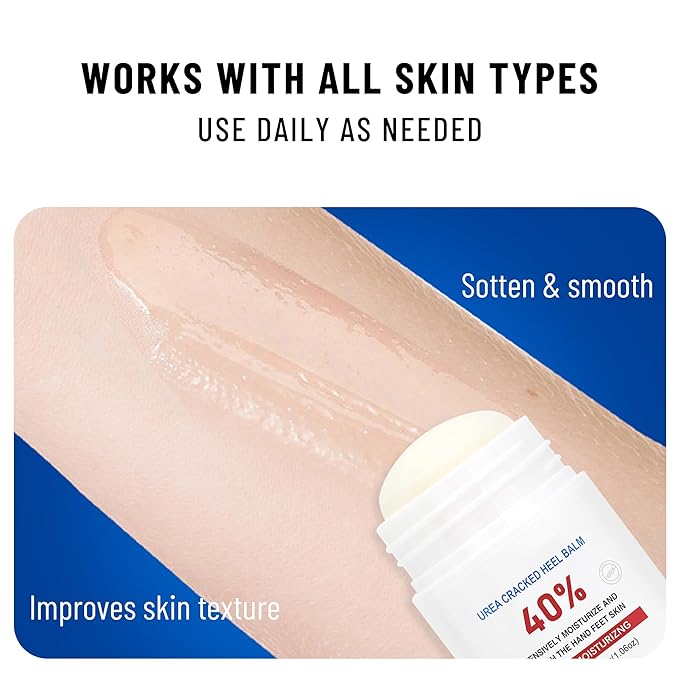 Urea Cream Stick 40 Percent,Heel Balm,Hand Cream and Foot Cream for Dry Cracked,Cracked Heel Treatment,Avoid Frostbite,40 Percent Urea Lotion for Feet Maximum Strength