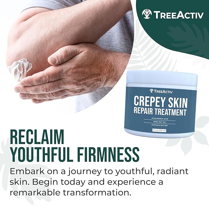 TreeActiv Crepey Skin Repair Treatment Original Formula, 8 fl oz, Firming Cream For Face & Neck, Skin Firming Lotion with Hyaluronic Acid, Crepey Treatment to Address Dry Crepe