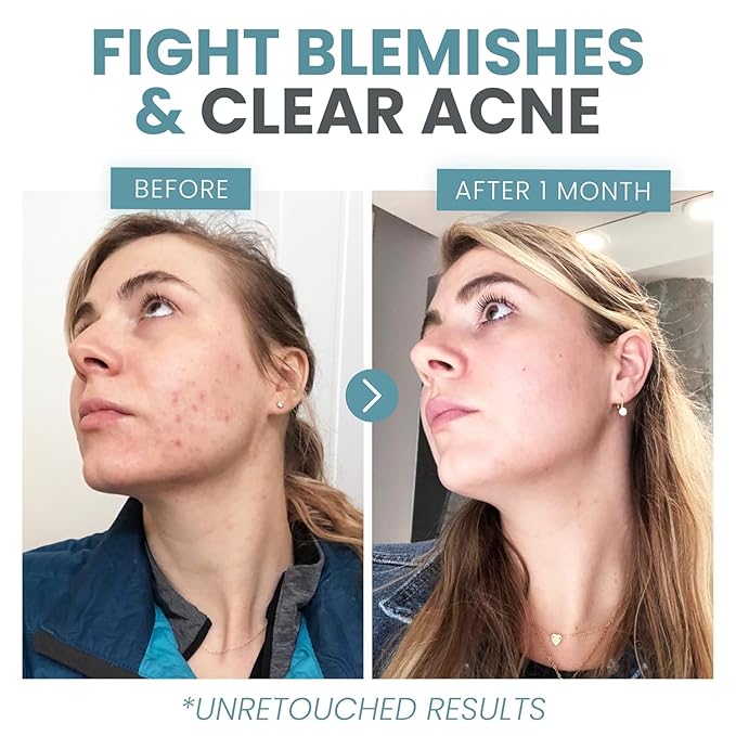 Vitamin C Serum Plus With Hyaluronic Acid, Retinol, Niacinamide, Salicylic Acid - Anti Aging Serum, Skin Clearing, Skin Brightening for Dark Spots (2 oz)