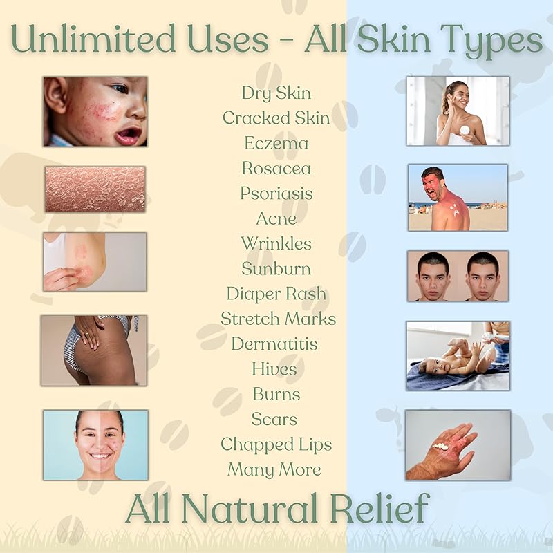 Beef Tallow for Skin - NAKED TALLOW BALM I 1 Ingredient - 100% Grass Fed Beef Tallow | Whole Body & Face | Whipped & UNSCENTED for Sensititve Dry Skin, Babies, Eczema, Psoriasis, Rosacea (9oz)