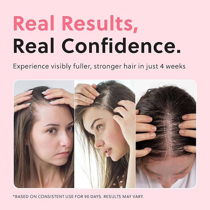 Advanced Hair Growth Oil Spray -Non-Greasy Hormone Free Formula - Promotes Thicker Natural Hair, Damage Repair, Loss Prevention, Ideal for Dry Scalp- ForHair