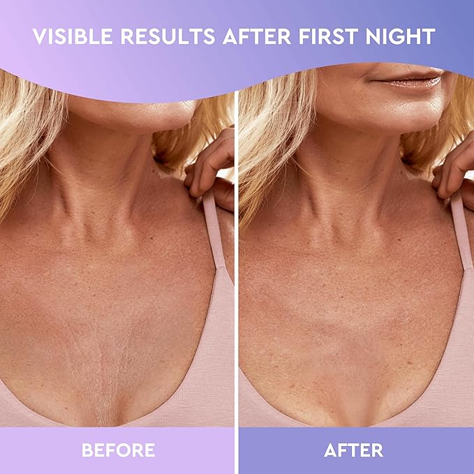 CLEVERFY Silicone Chest Wrinkle Pads for Décolleté - 2-Pack of T-Shape Reusable Anti-Wrinkle Patches