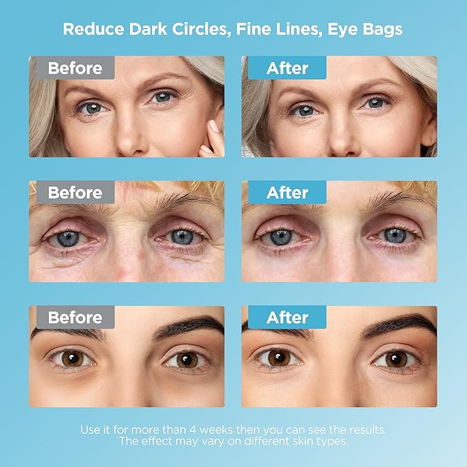 Dongyu Caffeine Eye Cream Set: Eye Serum Kit for Dark Circles Puffiness - Anti Aging Eye Cream Set for Fine Lines Wrinkles Day Night Use - Self Care Gifts for Women Birthday Gifts for Her