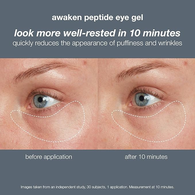 Dermalogica Awaken Peptide Eye Gel - Quickly Reduces the Appearance of Puffiness and Wrinkles