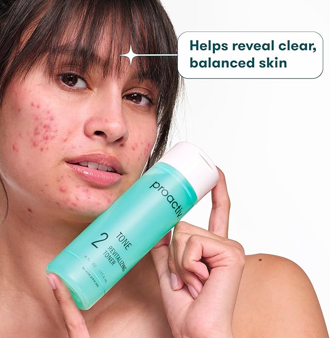 Proactiv Hydrating Facial Toner for Sensitive Skin Alcohol Free Toner for Face Care Pore Tightening Glycolic Acid and Witch Hazel Formula Acne to Balance & Remove Impurities, Light Teal, 6 Fl Oz