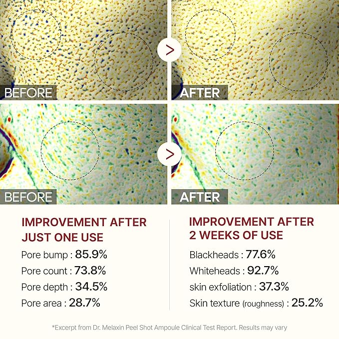 Peel Shot Glow White Rice Peeling Ampoule, Soft Exfoliating Face and Body Scrub Dead Skin Cells Remover for All Skin Types korean skin care 80ml