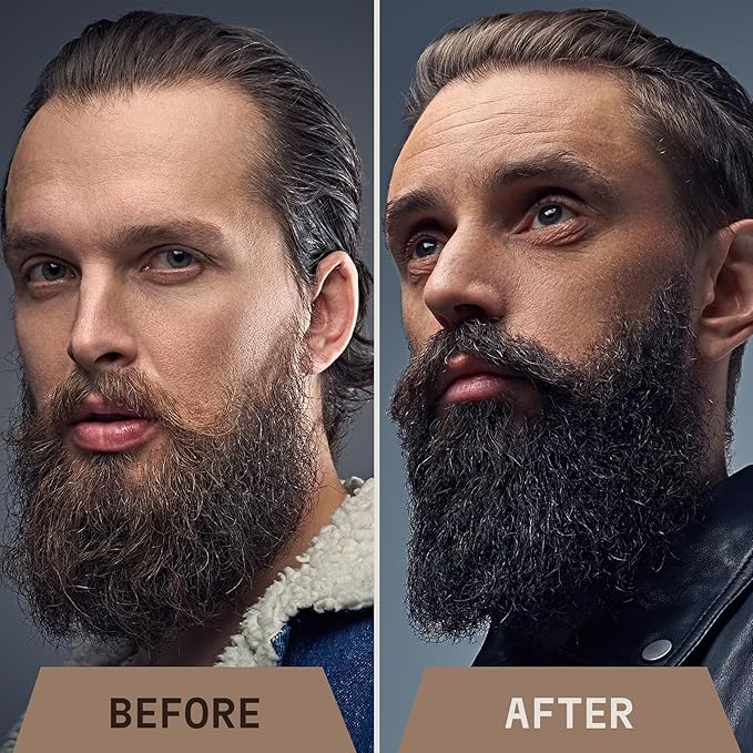 Striking Viking Beard Oil for Men - 2 Fl Oz, Sandalwood Scent - Naturally Derived Conditioner with Almond, Tea Tree, Argan & Jojoba Oil for Beard Growth, Softening & Moisturizing