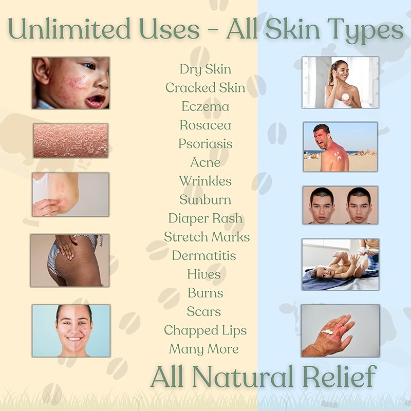 Beef Tallow for Skin | NAKED TALLOW BALM | 1 Ingredient - 100% Grass Fed Beef Tallow | Beef Tallow for Body & Face | Whipped & UNSCENTED for Sensititve Dry Skin, Babies, Eczema, Psoriasis, Rosacea (4oz)