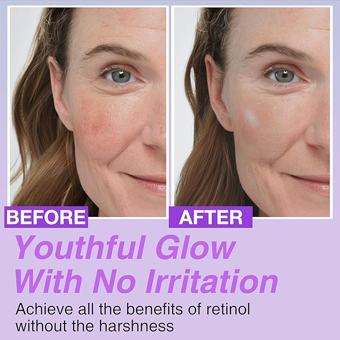 Korean Bakuchiol Concentrate Mix-in Serum 30,000 ppm - High Potency Retinol Alternative | Wrinkle Reduction Skin Firming & Smoothing - Anti-Aging Sensitive Skin Vegan & Cruelty-Free Non-GMO 2 oz