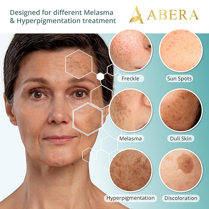 Abera Melasma Serum Plus with Niacinamide and Hyaluronic Acid, Dark Spot Corrector Serum, Melasma Treatment for Face, Suitable for All Skin Types, Set of 3