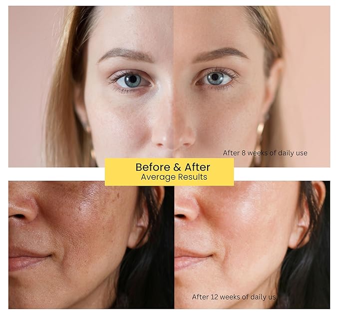 Korean Vitamin C Serum with Glutathione – 13% Stabilized Face Serum for Bright, Even Skin – Anti-Aging Ampoule for Dark Spots, Fine Lines & Wrinkles | 10 x 5ml (8 Week Supply)