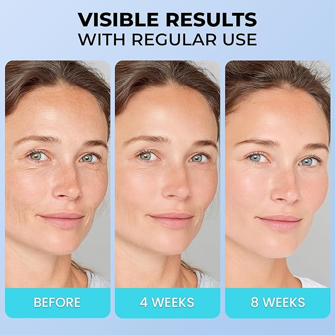 Face Moisturizer for Aging Skin: Wrinkle Cream for Older Women and Men 50 and 60 plus with Retinol, Collagen and Hyaluronic Acid – Facial Moisturizer for Mature Skin, 1.7 fl. Oz (Medium, Unscented)