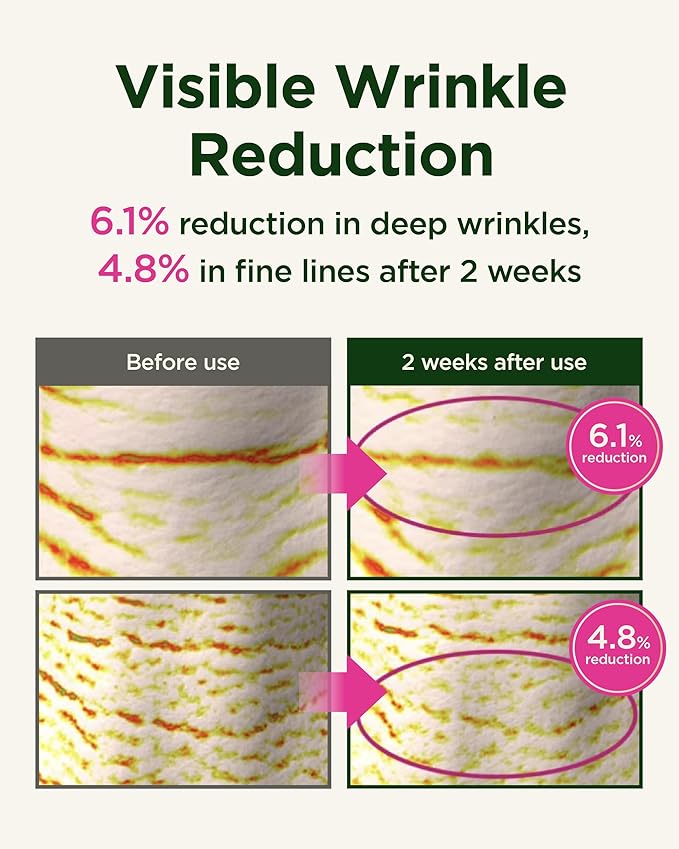 CKD Retinol Collagen Neck Cream with Gua Sha Massage Roller - Anti Aging Firming Cream for Neck & Jawline Lifting, Double Chin, and Décolleté Wrinkle Care. Korean Skincare. 1.69 fl oz