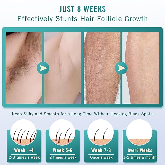 IPL Laser Hair Removal for Women and Men, Sapphire Ice-Cooling System for Nearly Painless & Long-Lasting Result Hair Removal Device at Home for Face, Legs, Arms, Bikini Line, Whole Body