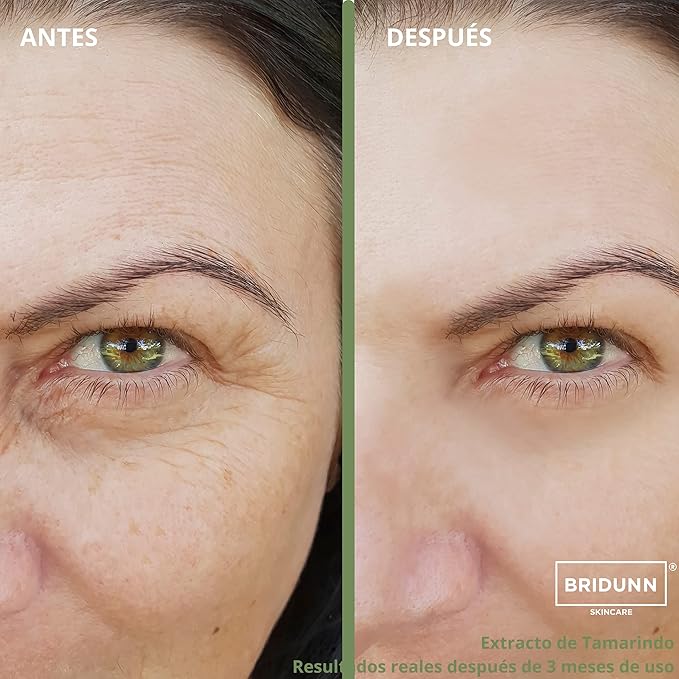 Anti Wrinkle & Face Tightening Regenerating Face Cream with Natural Ingredients