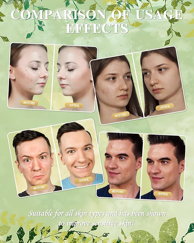 Beef Tallow for Skin - Whipped Tallow Balm with Manuka Honey, Handmade Moisturizer for Sensitive Skin (Unscented)