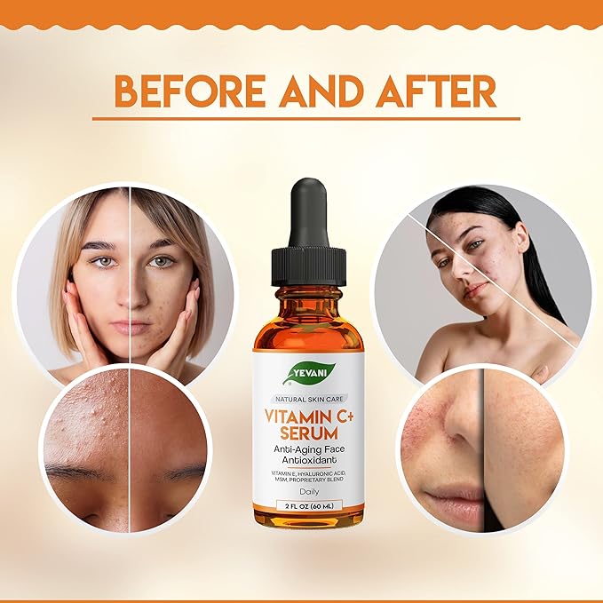 100% Pure Vitamin C Serum for Face with Hyaluronic Acid, Eye Area, Dark Spots, Anti Aging, Hydrating Skin Care with Vitamin E, Aloe Vera, Jojoba Oil, Dry Skin, Fine Lines, Wrinkles, 2 FL OZ