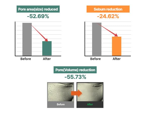 AQUA SQUALANE MOISTURIZING CREAM | Face Moisturizer for Dry and Sensitive Skin, Long-lasting Hydration, Pore Care Cream, Korean Skin Care (2.03 Fl Oz, 60ml)