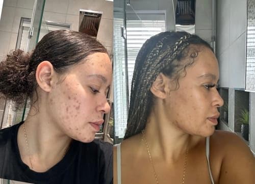 Turmeric & Kojic Infused Exfoliating & Cleansing Pads for Discoloration, Dark Spots, Uneven Skin. Deep Clean & Unclog Pores, Brighten, Glow & Smooth Skin (Pack of 30)