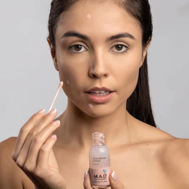 M.A.D Skincare Acne Drying Lotion - Intensive Overnight Spot Treatment [2 Pack]