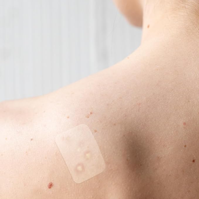 Target Patches for Face & Body - 42 Count, Hydrocolloid Acne Spot Stickers for Zits and Blemishes, Vegan, Cruelty-Free Acne Solution, Overnight Results