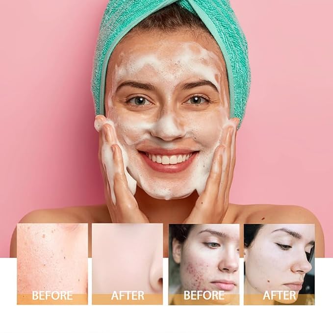 Turmeric Wash And Care Two Piece Set, Turmeric Facial Cleanser Turmeric Kojic Lemon Soap, Deep Cleansing Hydrating Facial Wash For All Skin Types (1)