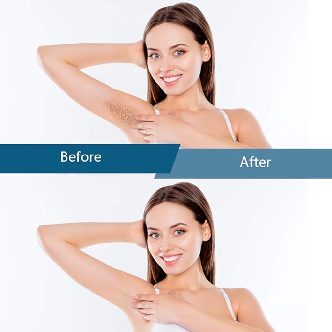 Bestidy Hard Wax Beads for Hair Removal - 1000g Waxing Beans for All Body and Bikini Areas (Blue)