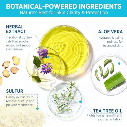 Tinea Versicolor Relief Cream & Soap: Clinically Proven Treatment for Tinea Versicolor, Athlete’s Foot, Ringworm, and Fungal Skin Conditions – Soothes, Cleanses, and Restores Skin Health