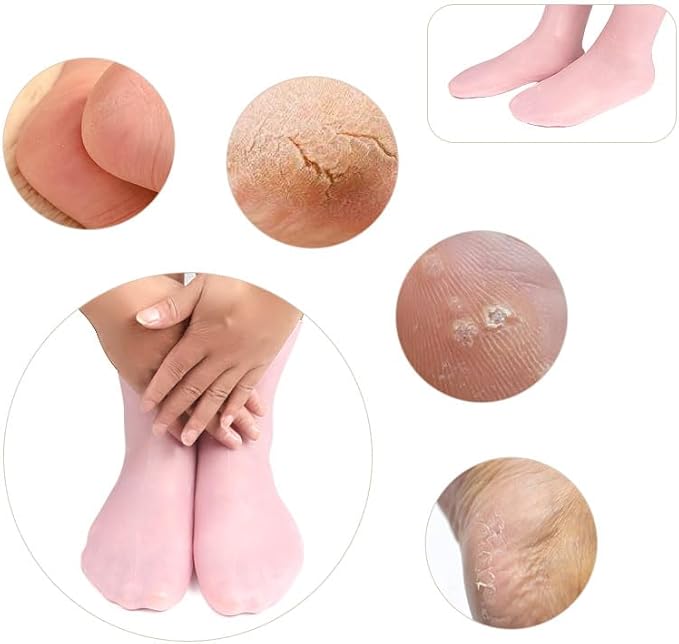 MoyRetty 3 Pairs Silicone Moisturizing Socks,Silicone Socks for Dry Cracked feet Women,Long Size,Spa Gel Socks Foot Care After Pedicure,High Elastic & Anti Slip(Pink & Beige & White)