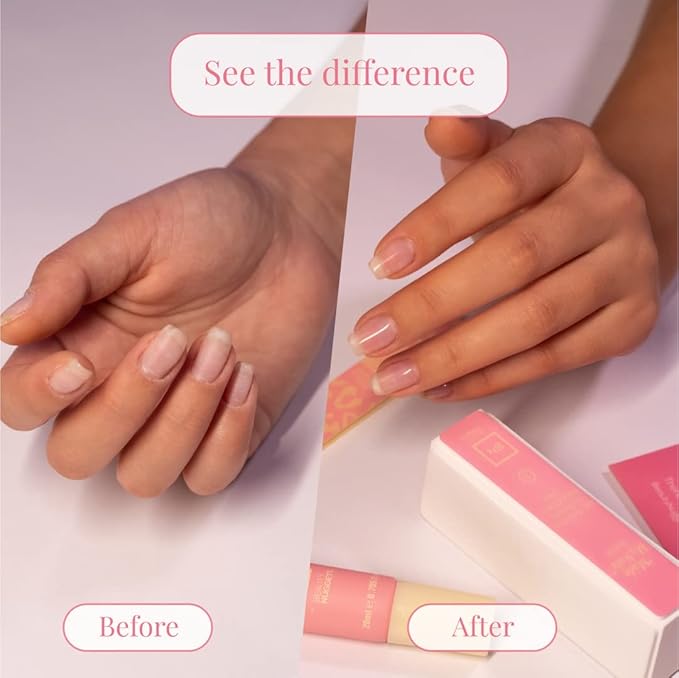 My Nails Are Perfect Nail Care Kit, Ultimate Shine 3 Way Nail Buffing Block, Cuticle Cream, Nail File and Replacement Buffer Pads (My Nails Are Perfect Nail Care Kit)