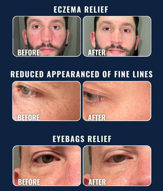 Prettyboy Face Revival Gel Moisturizer For Men - Hydrating Cream That Refreshes Dry Skin, Irritation, & Redness - Supports Anti Aging & Anti Wrinkle - Fragrance Free - 1 Count