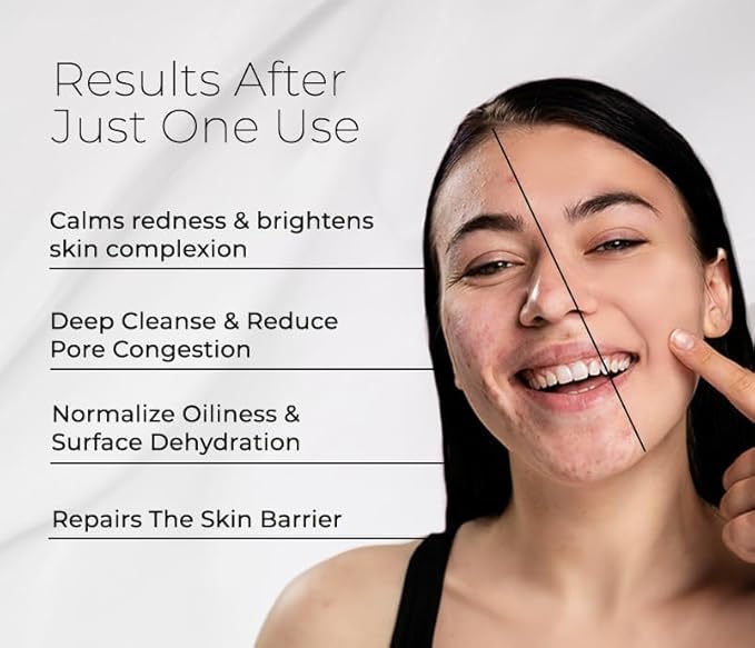 Bioactive Facial Cleanser for Oily Skin, our Face Wash Provides a Gentle Deep Clean and Eliminates Excess Oil (4.5 fl oz)