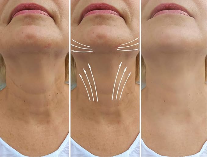 N.E.C.K Control: Neck Lifting, Firming And Retracting Cream