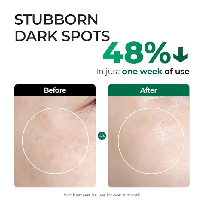 EASYDEW DW-EGF Melatoning One-Day Ampoule - Dark Spot Correcting Korean Facial Serum for Uneven Skin Tone & Dull Skin with EGF, Glutathione, Niacinamide - Age Defying Skincare, 0.03fl oz x 7ea