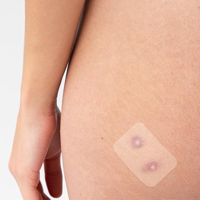 Target Patches for Face & Body - 42 Count, Hydrocolloid Acne Spot Stickers for Zits and Blemishes, Vegan, Cruelty-Free Acne Solution, Overnight Results