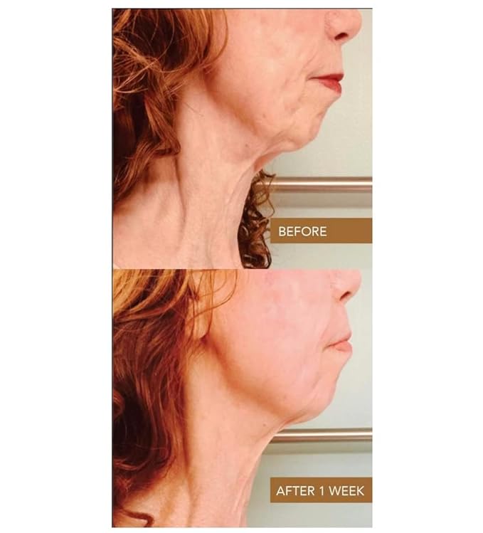 Cleopatra Neck Cream, 2oz – Firming & Lifting Neck Moisturizer with Colloidal Gold, Silk Peptides & Green Tea – Organic, Vegan – Reduces Wrinkles & Improves Elasticity