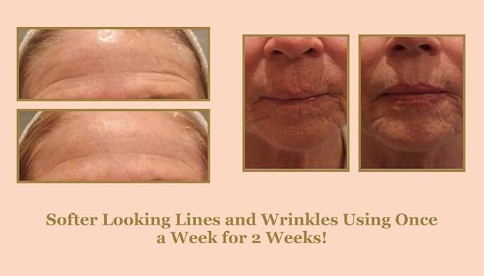 DIAMONDBUFF Microderm Exfoliation Tool for at Home Glowing and Radiant Skin | Reduce Acne, Fine Lines, Wrinkles, & Provide a Velvety Smooth Complexion with Diamond Microdermabrasion