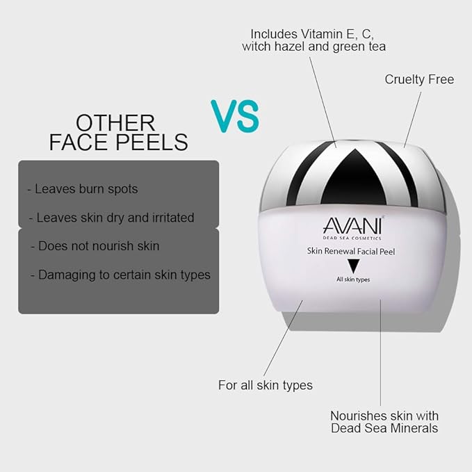 Avani Classics Skin Renewal Facial Peel - Brightening & Anti-Aging Formula - Exfoliating Cream with Vitamin C & E & Dead Sea Mineral - Safe & Gentle