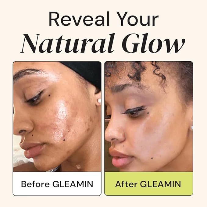 Gleamin Face Cream Moisturizer with Vitamin C, Shea Butter, Ceramides, and Turmeric - For Hydrating, Dry, Dull Skin, Visibly Brighten Discoloration & Dark Spots - 1.7 FL OZ Facial Brightening Cream