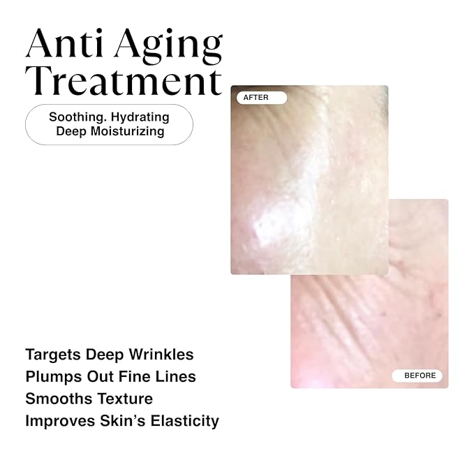 MATKAS Korean Active Capsule 0.05% Retinal Hybrid Cream 1.7 Fl. Oz. - Korean Skin Care Night Cream, Skin Care Moisturizer for Anti Aging Wrinkle Repair, 2% Niacinamide Retinaldehyde Serum for Face