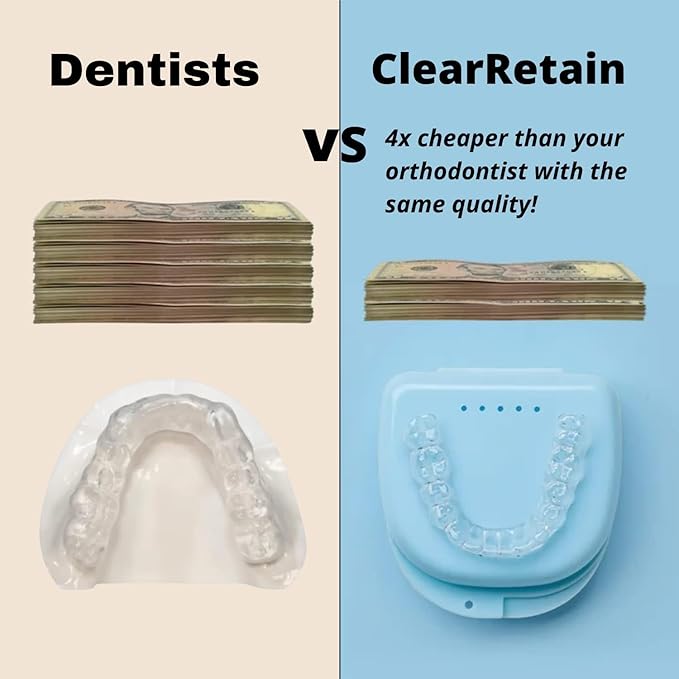 Custom Clear Dental Retainers Retainer | at Home Kit for Perfect Custom Fit Great for Replacement Retainers (Upper Only)