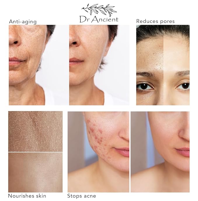 Snail Soap Bar Organic Natural Traditional Handmade Antique - Anti Aging, Effective For Acne And Skin Spot, Rejuvenate Your Skin Naturally - Absolutely No Chemicals! Pure Natural Soaps!