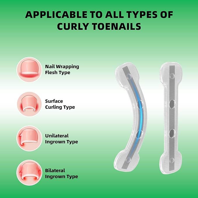 Ingrown Toenail Treatment, Nails Corrector Tool, Professional Toenail Correction Remover Repair Removal Kit for Rapid Relief