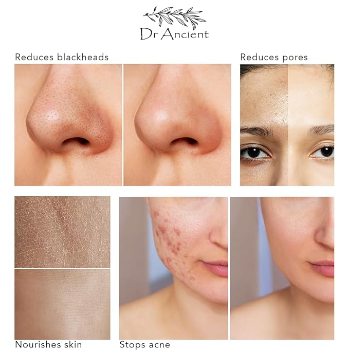 Clay Soap Bar Organic Natural Vegan Traditional Handmade Antique - Mineral Peeling, Exfoliating, Pore Minimizer, Treats Acne & Oily Skin - No Chemicals, Pure Natural Soaps!