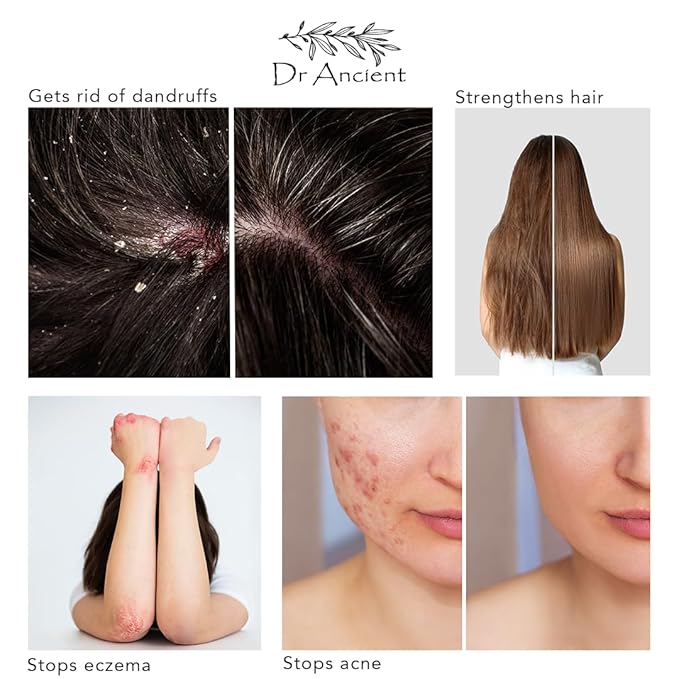 Bittim Soap + Aleppo Soap Organic Natural Vegan Traditional Handmade Antique - Absolutely No Chemicals!